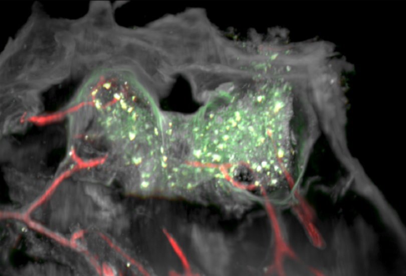 Medizinische Bildgebung des Schädelknochens. Fluoreszierende grüne Punkte...