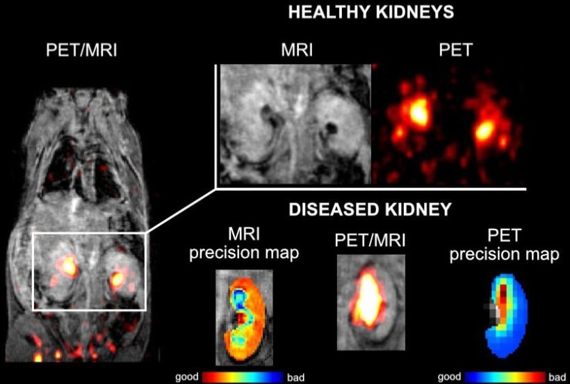 Collage of medical imaging modalities for kidney diseases, including MRI and...