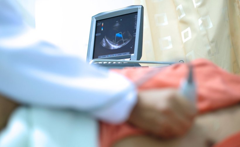 A physician performs an echocardiography examination on a patient. The...