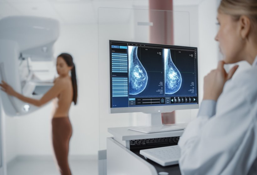 A female medical imaging expert watching computer screens with mammograms. In...