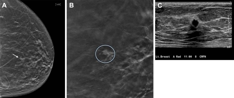 Three instances of medical breast imaging, performed with different modalities