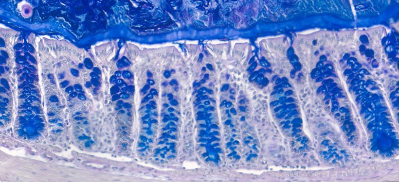 Colon cells in blue and grey