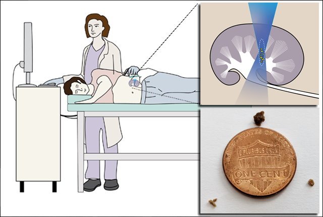 Cartoon illustration of a doctor using an ultrasound device to move a patients...