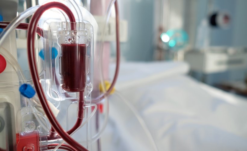 Dialyse-Maschine in der Intensivstation eines Krankenhauses