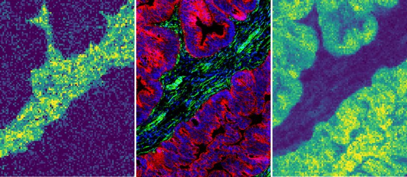 These three images show the exact same piece of tissue, but with different...