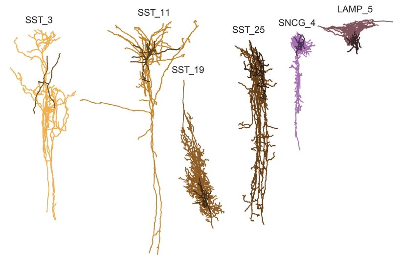 Computer generated image of six brain cells that may be harmed first by...