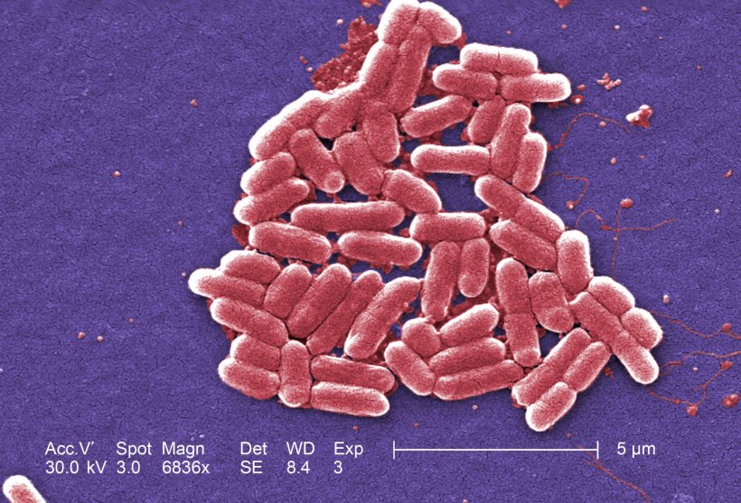 Rot eingefärbte stäbchenförmige Escherichia coli-Bakterien auf blauem...