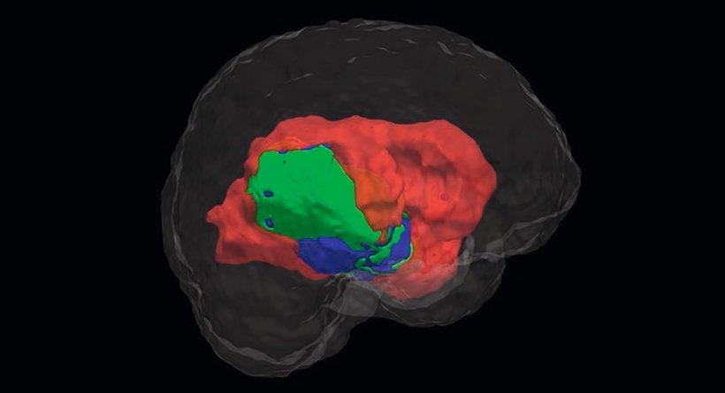 3d illustration of a transparent human brain with several structures...