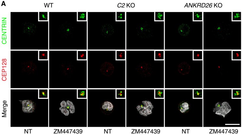 Recruitment of PIDD1 to the centrosome via the centrosomal adapter ANKRD26 is...