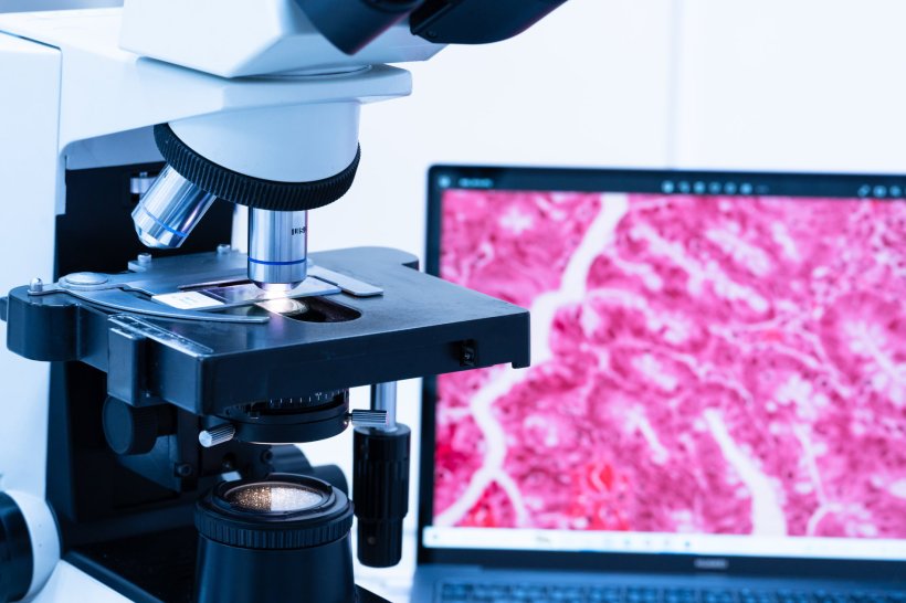 A microscope in front of a computer monitor displaying a histopathological image