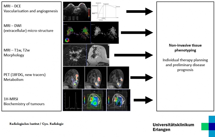 Parametric/molecular imaging in breast diagnostics