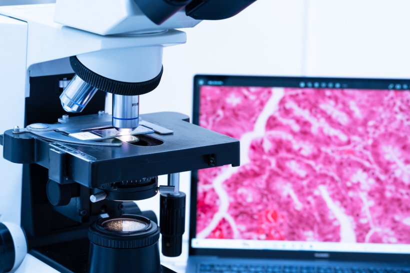 A microscope on a table. In the background, a computer monitor displays...
