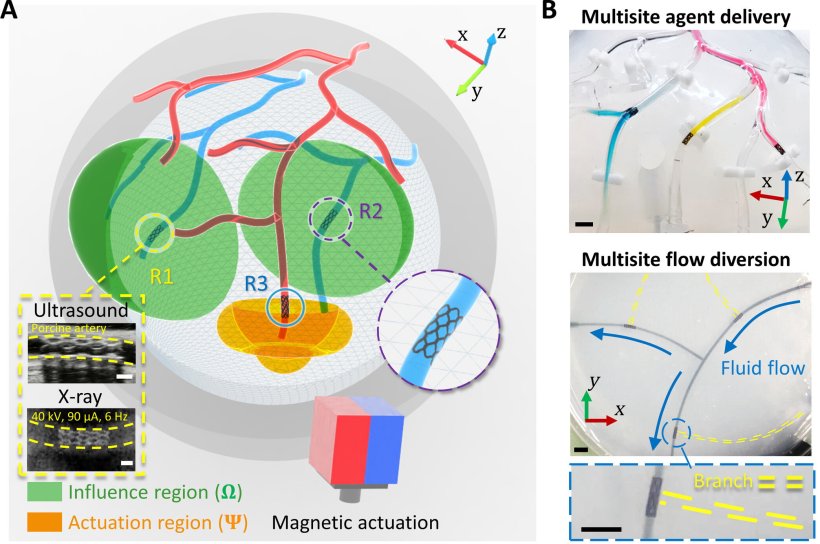 The magnetic robot is the shape of a stent, designed to flexibly adapt to...