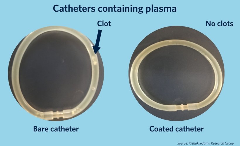 The uncoated catheter on the left shows a clot in the plasma, while the coated...