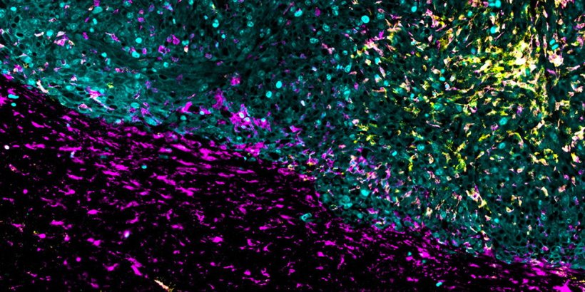 Microscopic image of tissue cross-sections of a mouse brain with a...