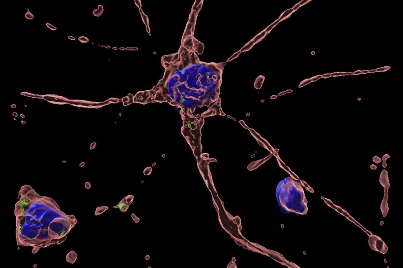 Mit Hepatitis E infizierte primäre Neurone aus menschlichen Nierenzellen, die...