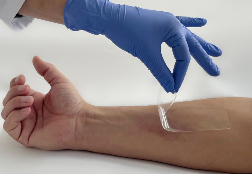 Hand in blue medical glove applies a transparent patch to a forearm