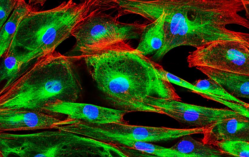 Konfokalmikroskopische Aufnahme von Fibroblasten