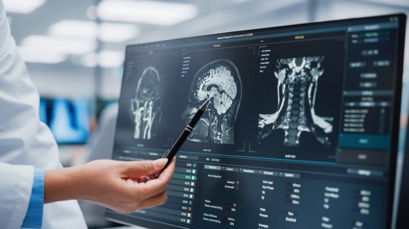 The hand of a doctor holding a pen, pointing towards a computer monitor...