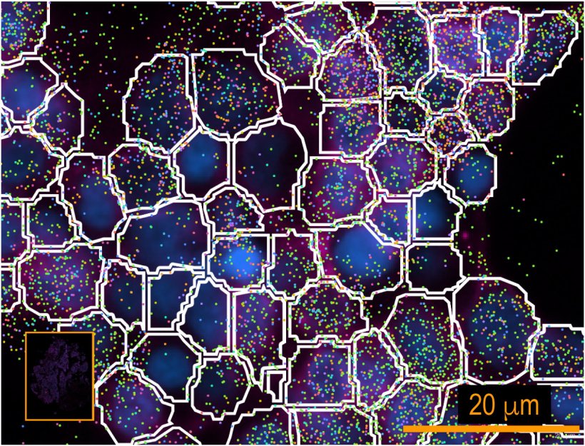 The colored dots are mRNAs inside the cells and the white boundaries are cell...