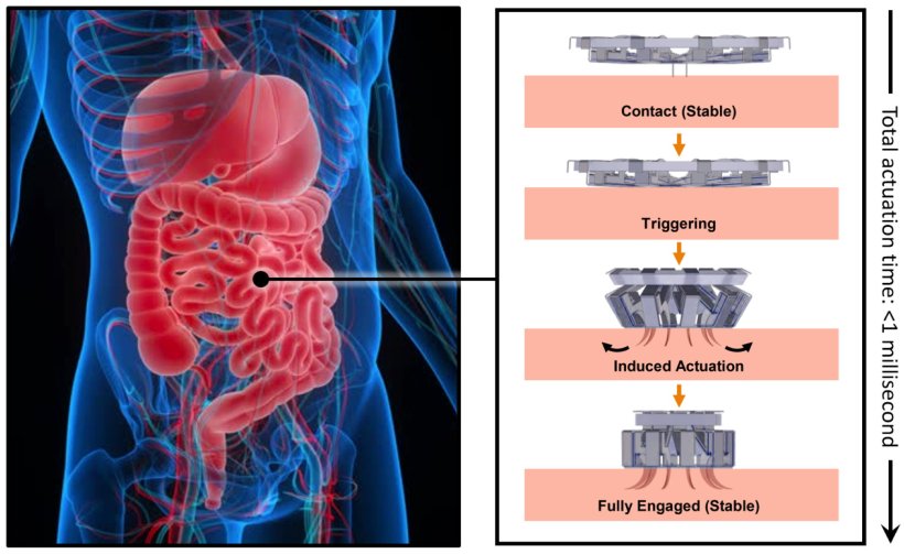 Flow chart illustrating the mechanism of action of the tapeworm-inspired tissue...