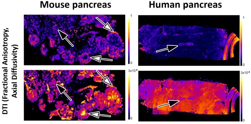 MRI microscopy of mouse and human pancreas, demonstrating the ability of DTI...