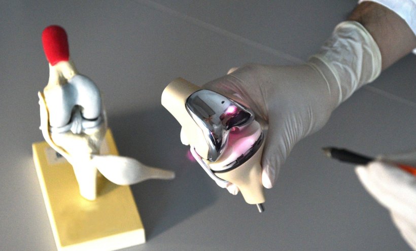 Model of a knee joint implant is held by a hand in a rubber glove