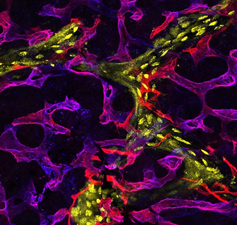 Kopplung von Typ-R-Kapillaren und Knochenumbau: Verteilung von EMCN+ VEGFR3 -...