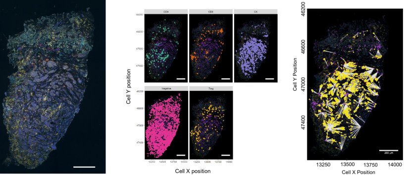 Maintenance of the immune microenvironment in patient-derived breast cancer...