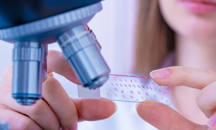 A female laboratory expert examining a tissue sample on a glass slide next to a...