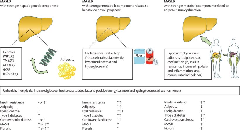 Die Grafik zeigt die drei unterschiedlichen Pathomechanismen der MASLD und ihre...