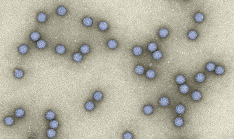 Poliovirus micrography, showing spherical virus particles