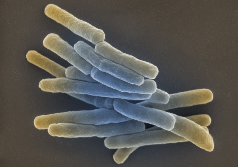 REM-Aufnahme von stäbchenförmigen Bakterien, der Tuberkulose-Erreger...