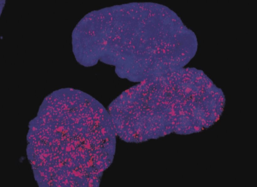 Persister cancer cells present heterochromatin mark H4K20me3 (red) foci.