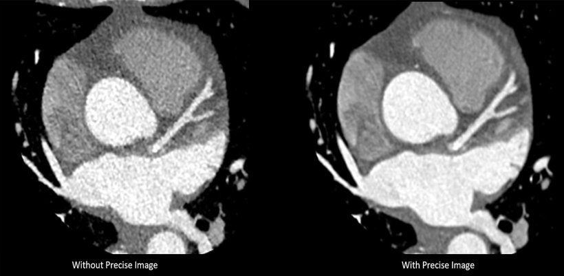 Two cardiac CT images