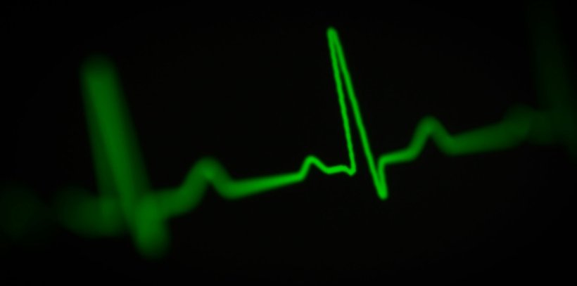 A green ECG heartbeat line on a black background