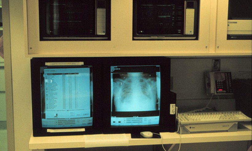 An early PACS ICU display station