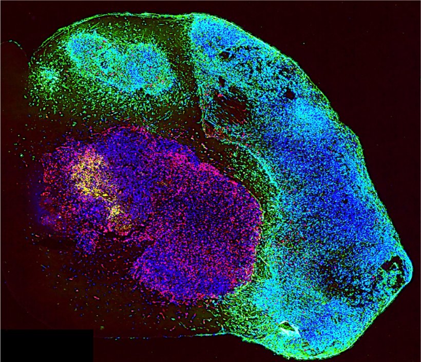 Microfotografie eines IPTO: Das aus pluripotenten Stammzellen gezüchtete...