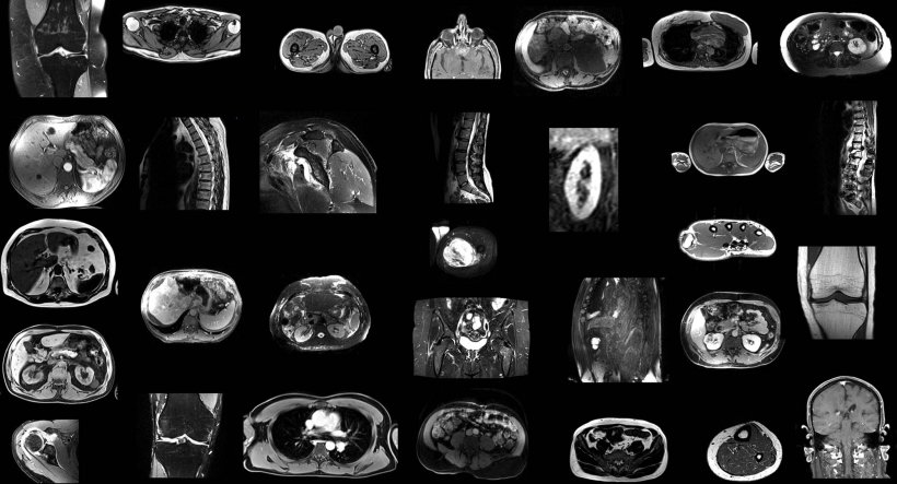 AI-segmented MRI images arranged in a 7x4 grid