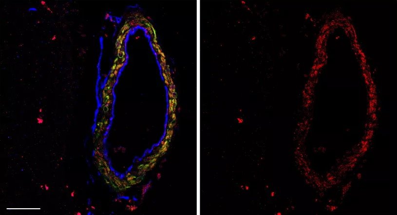 Researchers examined brain surface blood vessels. The artery lining appears...