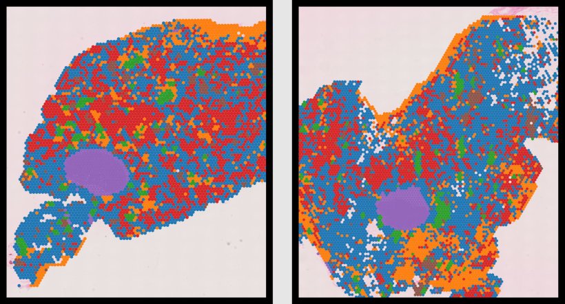 A spatial transcriptomics analysis showing six enriched cell types in...