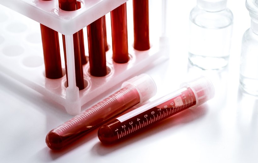 Several test tubes filled with blood in a tube rack and lying next to it