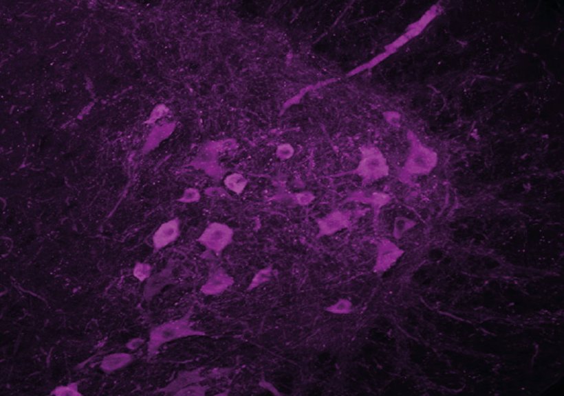 Motor neurons (stained by immunohistochemistry for ChAT) of the lumbar section...