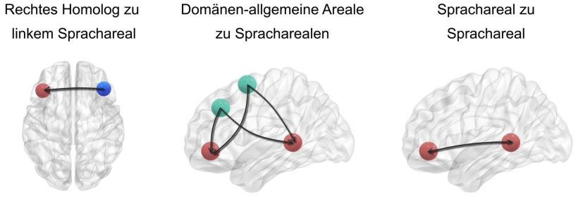 Drei Prinzipien der Netzwerkinteraktion bei der Spracherholung