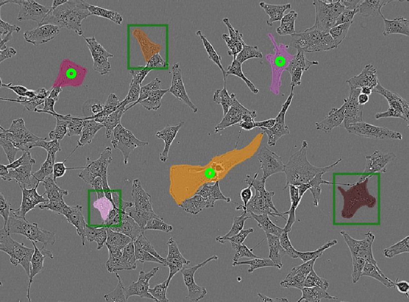 Segmentierung von Zellen in der Lichtmikroskopie mit μSAM. Das Bild zeigt, wie...