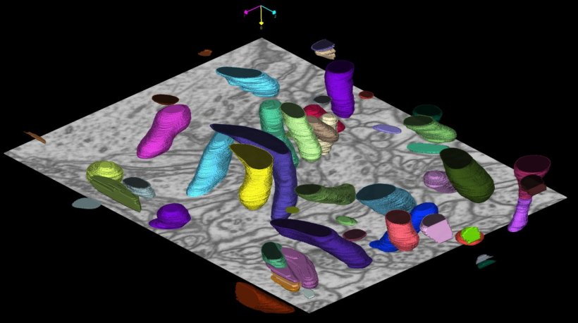 Automatische Segmentierung von Mitochondrien – den „Kraftwerken“ der...