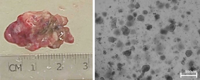 Links: Tumorgewebe von Patienten. Rechts: Aus dem Tumorgewebe generierte...