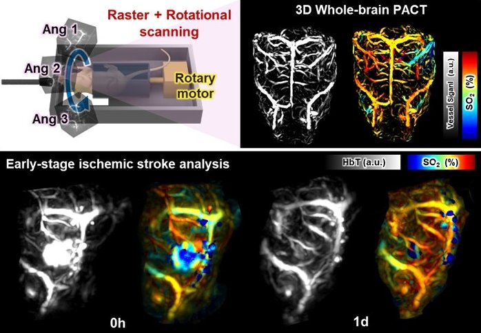 Visualization of the entire cerebrovascular structure and observation of acute...