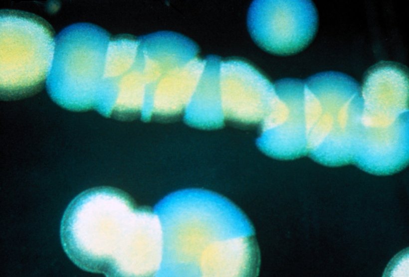 A row of bokeh-like yellow and blue dots against a black background
