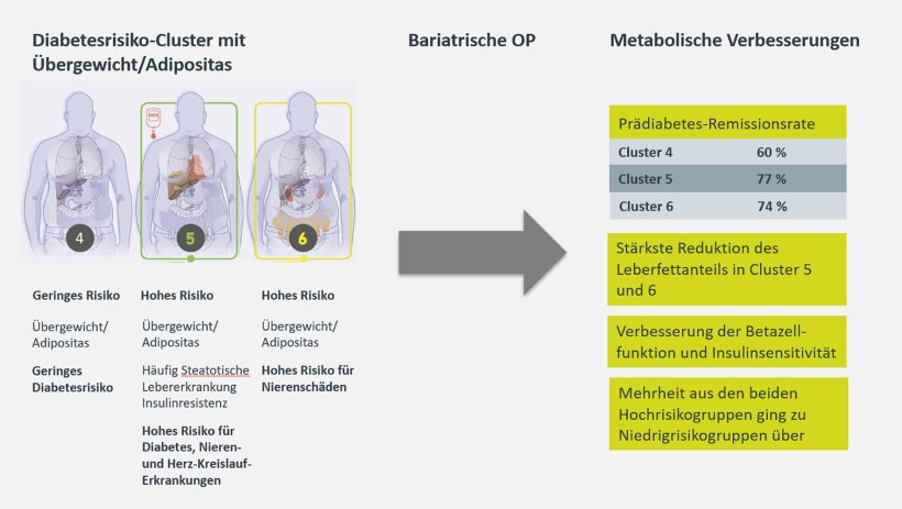 Schematische Darstllung der Subtypen für ein Diabetes-Typ-2-Risiko